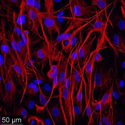 : Astrocytes generated from Huntington's Disease human induced pluripotent stem cells (iPSCs) exhibited a typical astrocyte morphology and expressed astrocyte markers glial fibrillary acidic protein