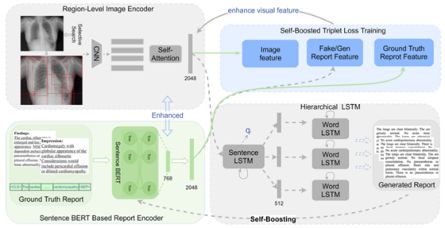 A Self-boosting Framework for Automated Radiographic Report Generation