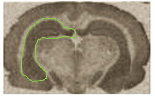 Visualising cannabinoid receptors in the brain: The hippocampus (a major region involved in learning and memory) from one side of the brain shown in green. Darker regions demonstrate higher levels of cannabinoid receptors.