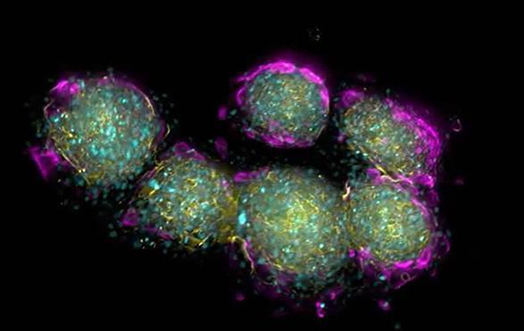 3D co-culture of lymph node-derived fibroblasts
