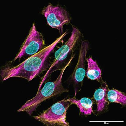 High-magnification imaging of the skin cancer cell line, UW-CSCC1