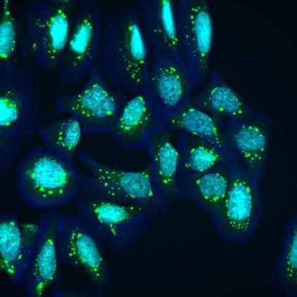 a compilation of U2OS cells undergoing treatments that create stressful cell conditions. In the images, we have oxidative and heat stresses. In response, cells enable the formation of biomolecular condensates known as stress granules to sequester RNA and translational machinery.