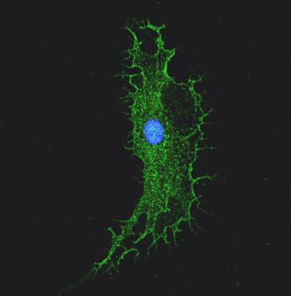 iPSC-derived microglia stained for the microglia marker IBA1 to visualise the morphological changes between healthy controls and patient lines.