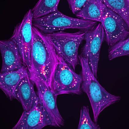 a compilation of U2OS cells undergoing treatments that create stressful cell conditions. The images show oxidative and heat stresses