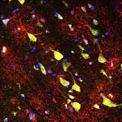 : Anterior cingulate cortex brain tissue from an individual with major depressive disorder stained for astrocytes (red, GFAP), neurons (yellow, NeuN) and FKBP5 (green). Nuclei indicated in blue.