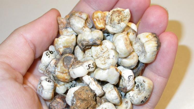 Brunch of teeth in a person's hand